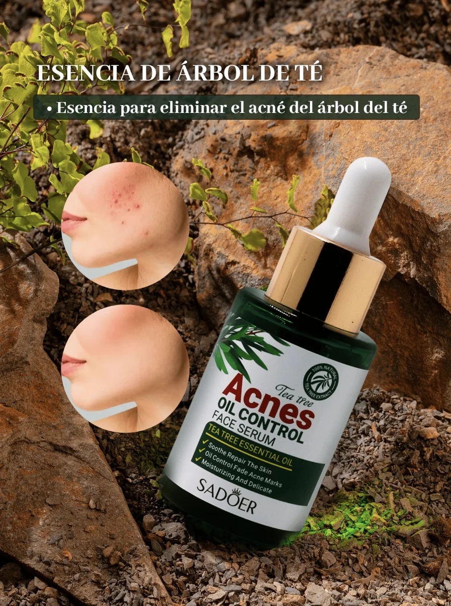 Suero Anti-acné con Ácido Salicílico y Arbol de Té Suero Anti-acné con Ácido Salicílico y Arbol de Té