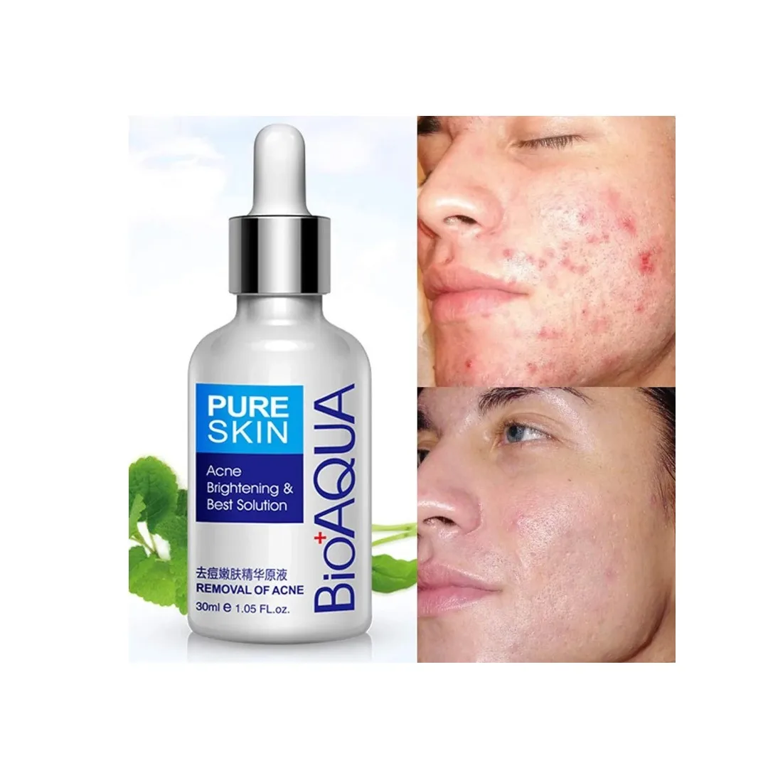 Sérum Pure Skin x2 Antiacné Aclarante de Manchas Sérum Pure Skin x2 Antiacné Aclarante de Manchas