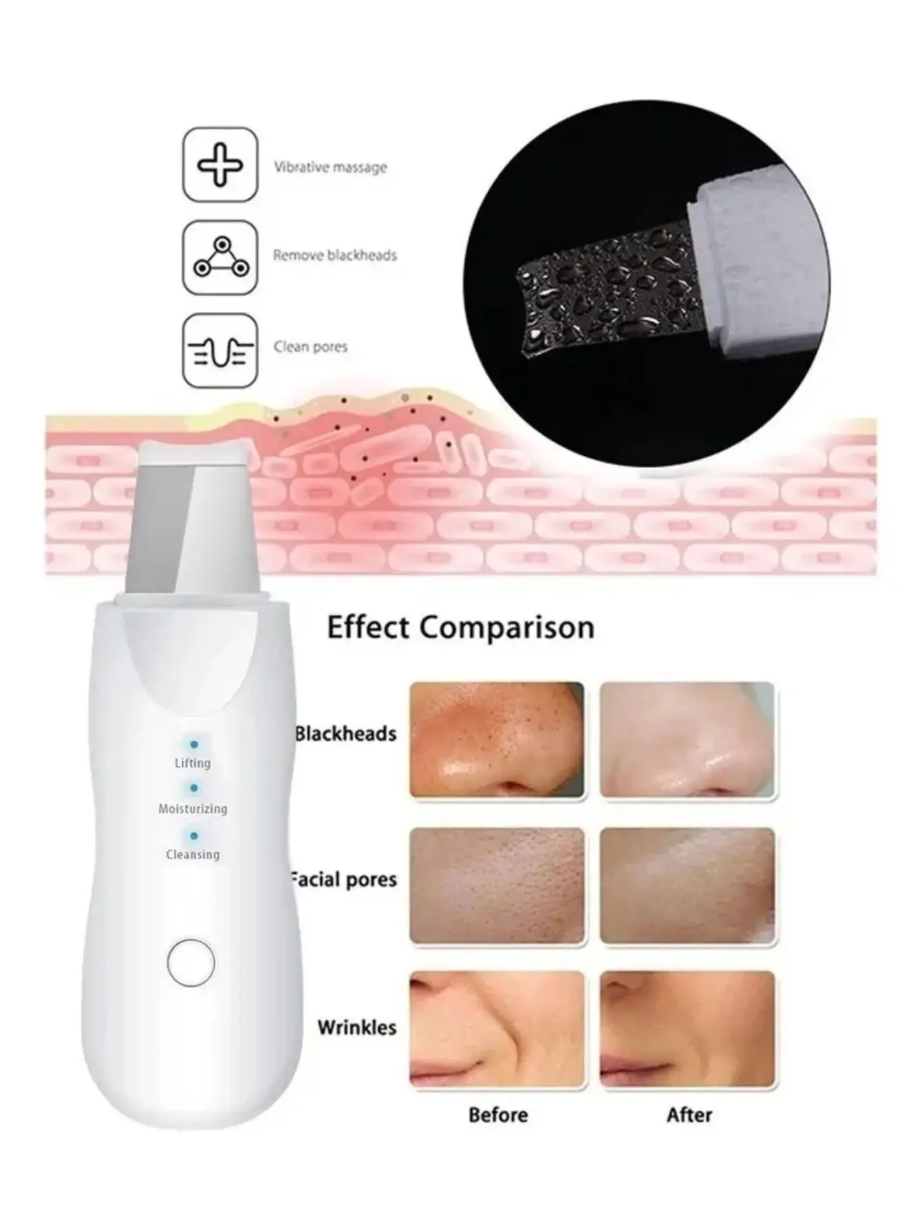 Limpiador Facial y Removedor de Puntos Negros Limpiador Limpiador Facial y Removedor de Puntos Negros Limpiador